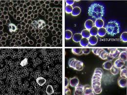 microscopia campo oscuro 1